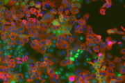 Neu entdeckter Wirt-Mechanismus bei Coronaviren