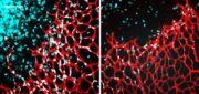 Cystinstoffwechsel: Neues therapeutisches Ziel zur Förderung der Gefäßregeneration entdeckt