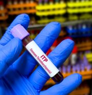 ASH 2025: Zusatz von Ianalumab verlängert bei vorbehandelter ITP die Zeit bis zum Therapieversagen