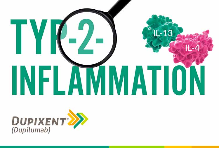 Typ-2-Inflammation