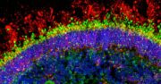 Netzhauterkrankung: Organoid-Plattform identifiziert Biomarker und ermöglicht Gentests