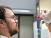 Hydrogel soll Heilung chronischer Wunden verbessern