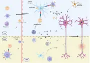 Multiple Sklerose liefert immunologische Ansätze zur Behandlung von Parkinson