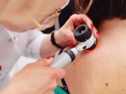 Melanomzellen sabotieren Immunabwehr durch extrazelluläre Vesikel