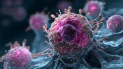 HIV-Medikament könnte Tumorwachstum beim Glioblastom reduzieren