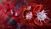 Gemeinsame Ursache von Thrombosen und Aortenaneurysmen entdeckt