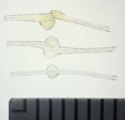 Glaukom: Gängige Augensalben können Implantate schädigen