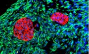 Graduiertenkolleg: Mit Organoiden Krebstherapie verbessern
