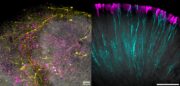 Retinale Organoide: Gefäßnetzwerke verbessern Überleben und Funktion von Sehnervzellen