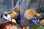 Vor beidseitiger Lungentransplantation: Patient lebt 48 Stunden ohne Lunge