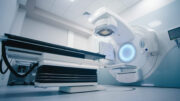 Protonen- versus Photonen-Strahlentherapie beim Oropharynxkarzinom