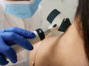 Desmoplastisches Melanom: Immuntherapie vor OP verkleinert Tumoren
