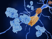 Rückschlag für Alzheimer-Wirkstoff Lecanemab