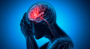 Neuroprotektives Medikament reduziert Beeinträchtigungen nach Schlaganfall