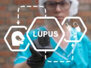 Neues Lupus-Modell verdeutlicht die Rolle der Keratinozyten