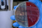 Welche Stämme von Staphylococcus aureus sind für Frühgeborene am gefährlichsten?