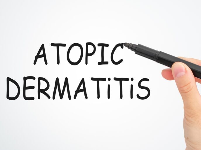 Atopische Dermatitis