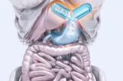 Typ-2-Diabetes: Orforglipron reduziert Blutzuckerspiegel und Gewicht besser als orales Semaglutid