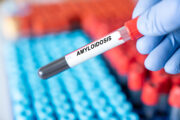 Blutmarker für Alzheimer könnte auch bei systemischer Amyloidose nützlich sein
