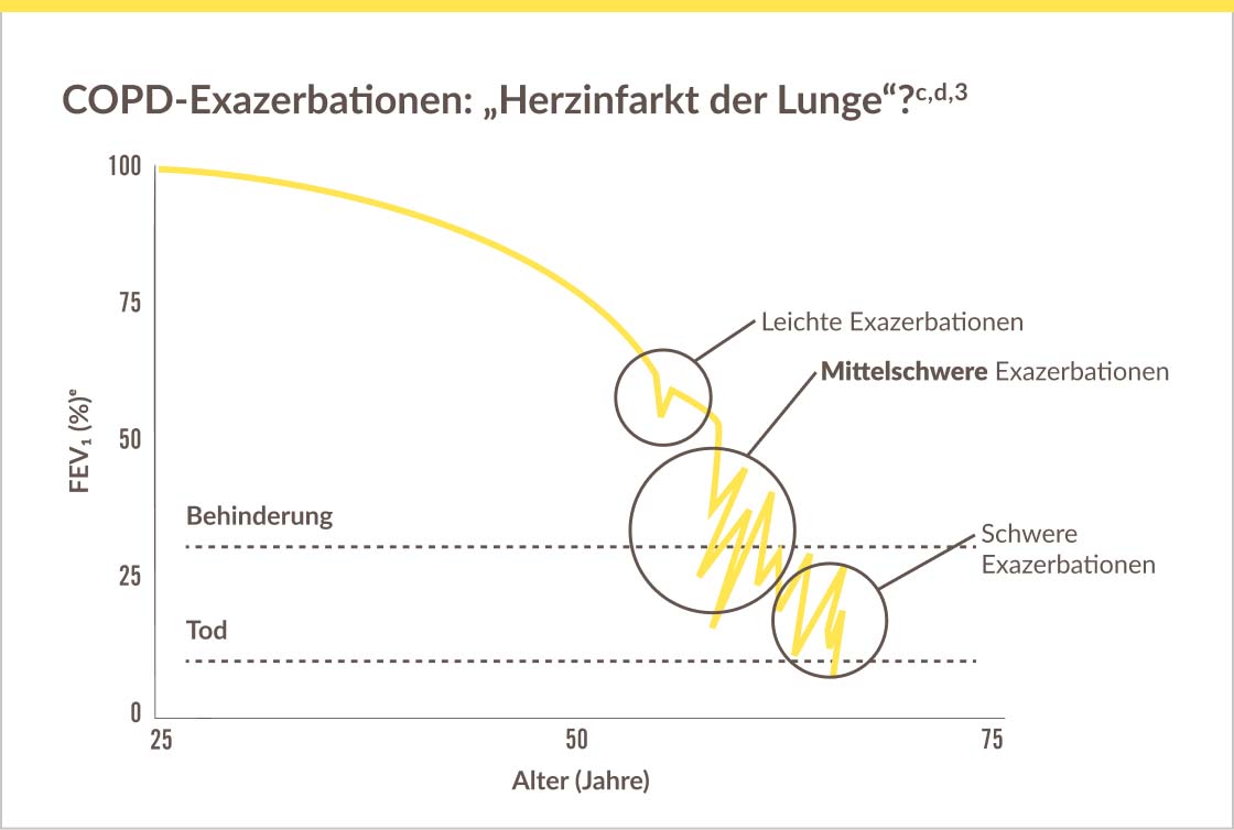 Grafik-Herzinfarkt-der-Lunge