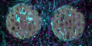 Ist das Knochenimplantat der Zukunft ein neuartiges Hydrogel?