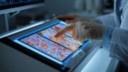 KI in der Pathologie: SPARK ermöglicht tieferes Verständnis von Tumorerkrankungen