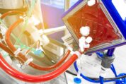 VA-ECMO bei Hochrisiko-Lungenembolie: Kein klarer Überlebensvorteil durch frühe mechanische Reperfusion