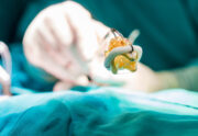 Partielle Herztransplantation kann Versorgung von Kindern mit Herzklappenerkrankungen verbessern