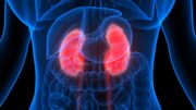 Typ-2-Diabetes und CKD: Metaanalyse vergleicht Wirksamkeit neuartiger Antidiabetika