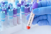 BRCA-Gene: Pathogene Varianten mit weiteren Krebsarten assoziiert