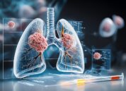 Neue Hoffnung bei Kleinzelligem Lungenkrebs: Weiterentwicklung der CAR-T-Zelltherapie