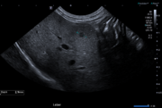 Zum World Liver Day 2026: Chronisch immunmediierte Hepatitis beim Hund