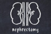 Chirurgischer Erfolg nach partieller Nephrektomie: Tumordurchmesser aussagekräftiger als Nephrometrie-Scores