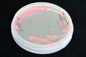Pseudomonas aeruginosa: Mechanismen der Resistenzevolution