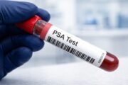 Cochrane-Review: PSA-Screening senkt wahrscheinlich die Sterblichkeit durch Prostatakrebs