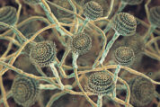 Aspergillus-Infektionen: Bestimmtes Protein ist entscheidend für die Bekämpfung