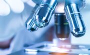 Alzheimer: Neue Mikroskopiertechnologie deckt unbekannte Immunzellen auf
