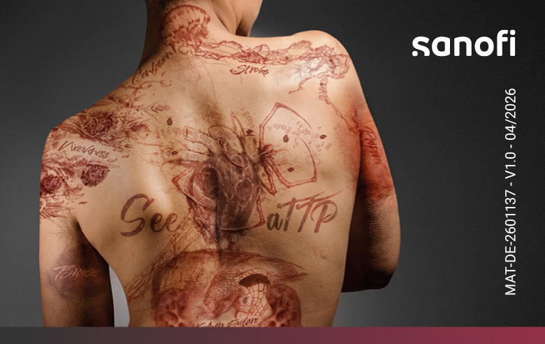 Biermann_Web-Advertorial_390x246px_V1