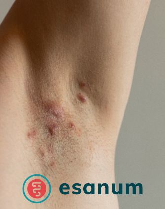 Esanum