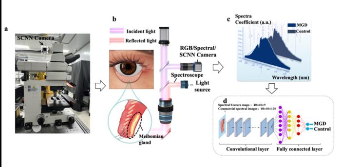 a Eine auf einer Metafläche basierende SCNN-Kamera (spektrales Convolutional Neural Network; schwarze Pfeilspitze), die in ein optisches Mikroskop integriert ist, erfasst spektrale Merkmalskarten von Gewebeschnitten der Meibom-Drüsen. b Versuchsaufbau für die spektrale Bildgebung von pathologischen Schnitten der Meibom-Drüsen. c Repräsentative rekonstruierte Spektralkurven von MGD-Patienten und gesunden Kontrollpersonen. d Schematische Darstellung der CNN-Architektur, die für die Klassifizierung von MGD und Nicht-MGD verwendet wird. Diese Abbildung veranschaulicht den gesamten Arbeitsablauf von der Probenbildgebung bis zur KI-basierten Diagnose. Bild:©Shi Y, Liu T et al./PhotoniX