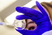Implantierbare „Zytokin-Fabriken“ zur Behandlung des Ovarialkarzinoms