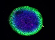 Infrarotlicht-aktiviertes Nano-Medikament: Nanozyme gegen Hirntumore