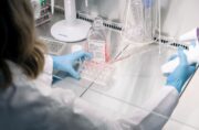 Modellstudie zum Antiepileptikum Valproat: Einfluss auf frühe Hirnentwicklung