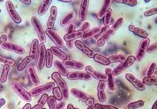 Tuberkulose: Neuer Genomtest deckt unerkannte arzneimittelresistente Erkrankung auf