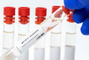 Erbgutschäden durch Methyleugenol: Wichtiger Reparaturmechanismus in Zellen entschlüsselt