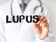 Hydroxychloroquin bei diskoidem Lupus erythematodes