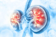 Biomarker-gesteuerte Immunsuppression nach Nierentransplantation erfolgreich getestet
