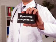 Genetische Ursache für Pyoderma gangraenosum identifiziert