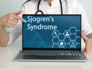 Sjögren-Syndrom: Wirksame Behandlung mit Kombitherapie