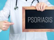 Biologika bei Psoriasis: Krankheitskontrolle auch mit reduzierter Dosis